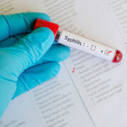 Hand in einem blauen Handschuhe hält einen positiven Syphilis-Test